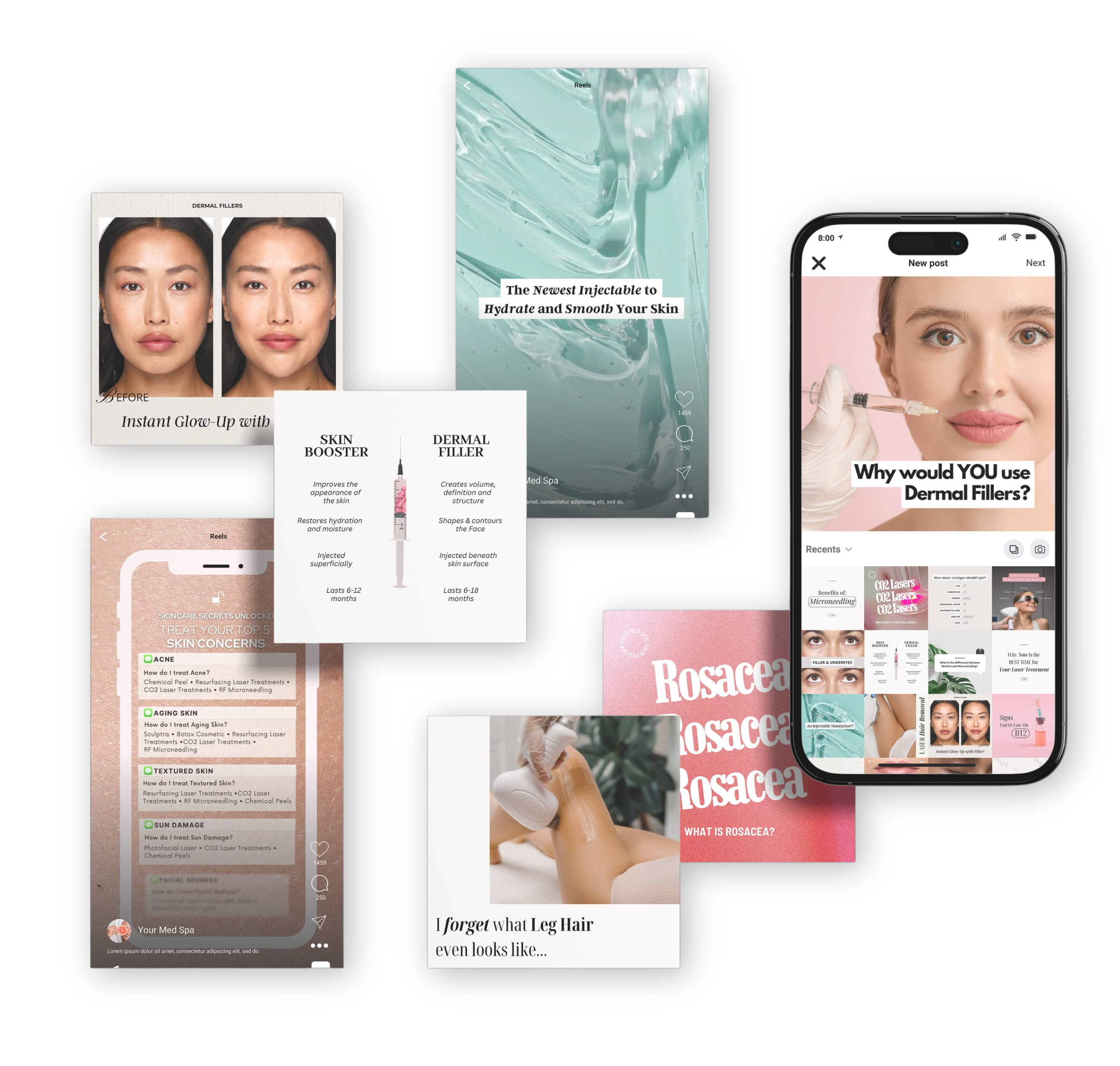 Collection of high-converting med spa social media post designs created by Media by Liz, featuring educational content on dermal fillers, rosacea, laser hair removal, and skin boosters.