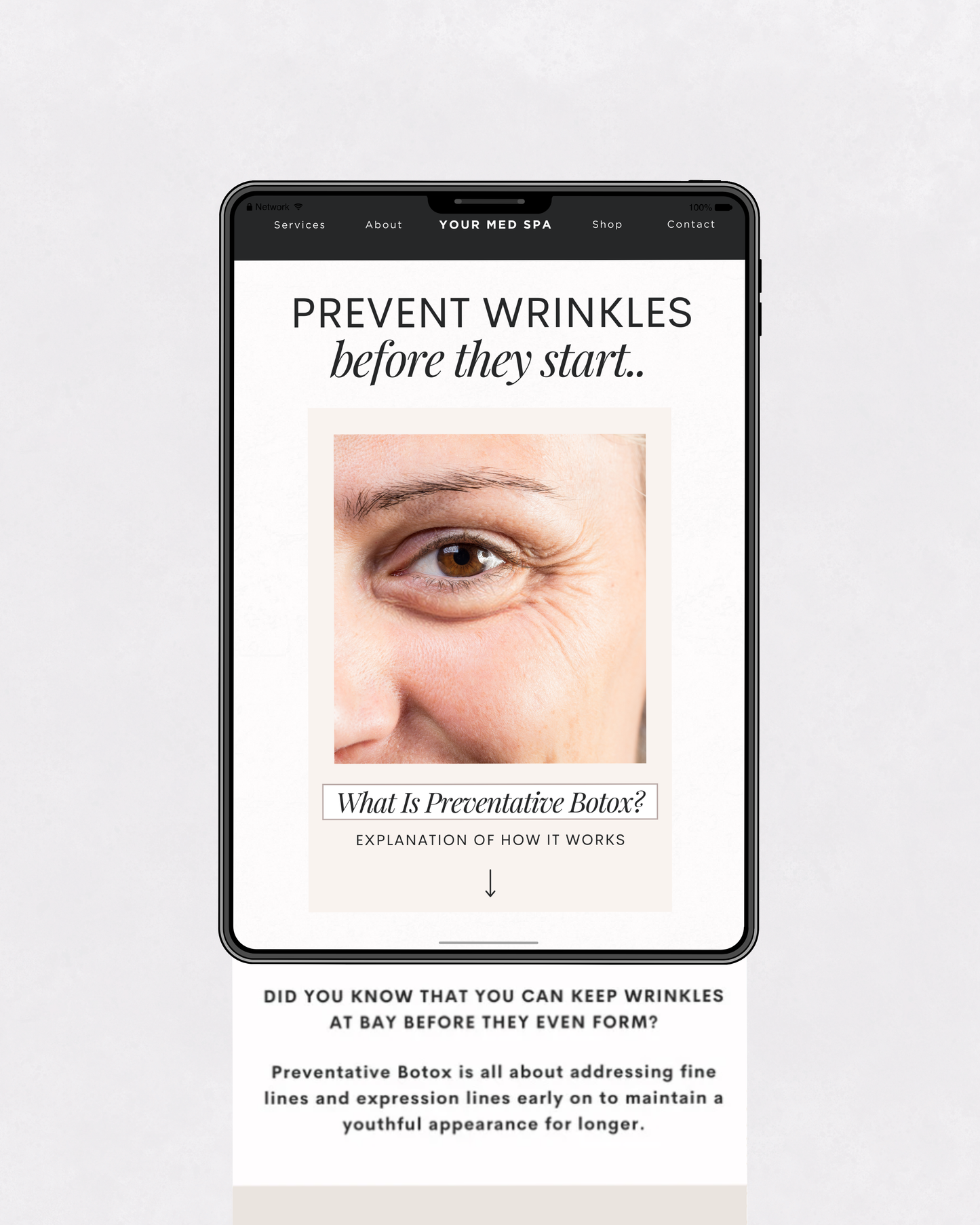 Med spa email template mockup explaining preventative Botox treatments to reduce fine lines and delay wrinkle formation.