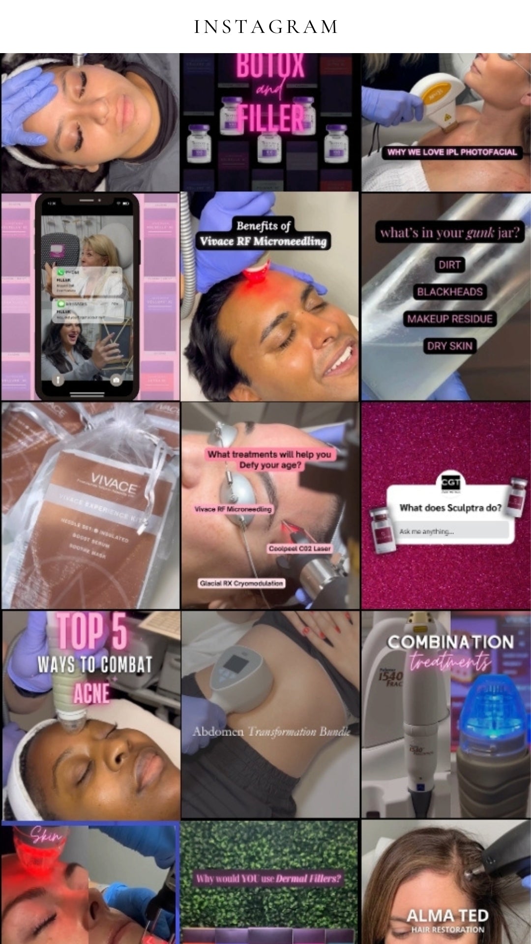 Instagram content examples for Med Spa, featuring social media posts on Botox and filler, IPL Photofacial, Vivace RF Microneedling benefits, acne treatments, combination therapies, CoolPeel CO2 laser, Sculptra Q&A, and Alma TED hair restoration. Social media management by Media by Liz.