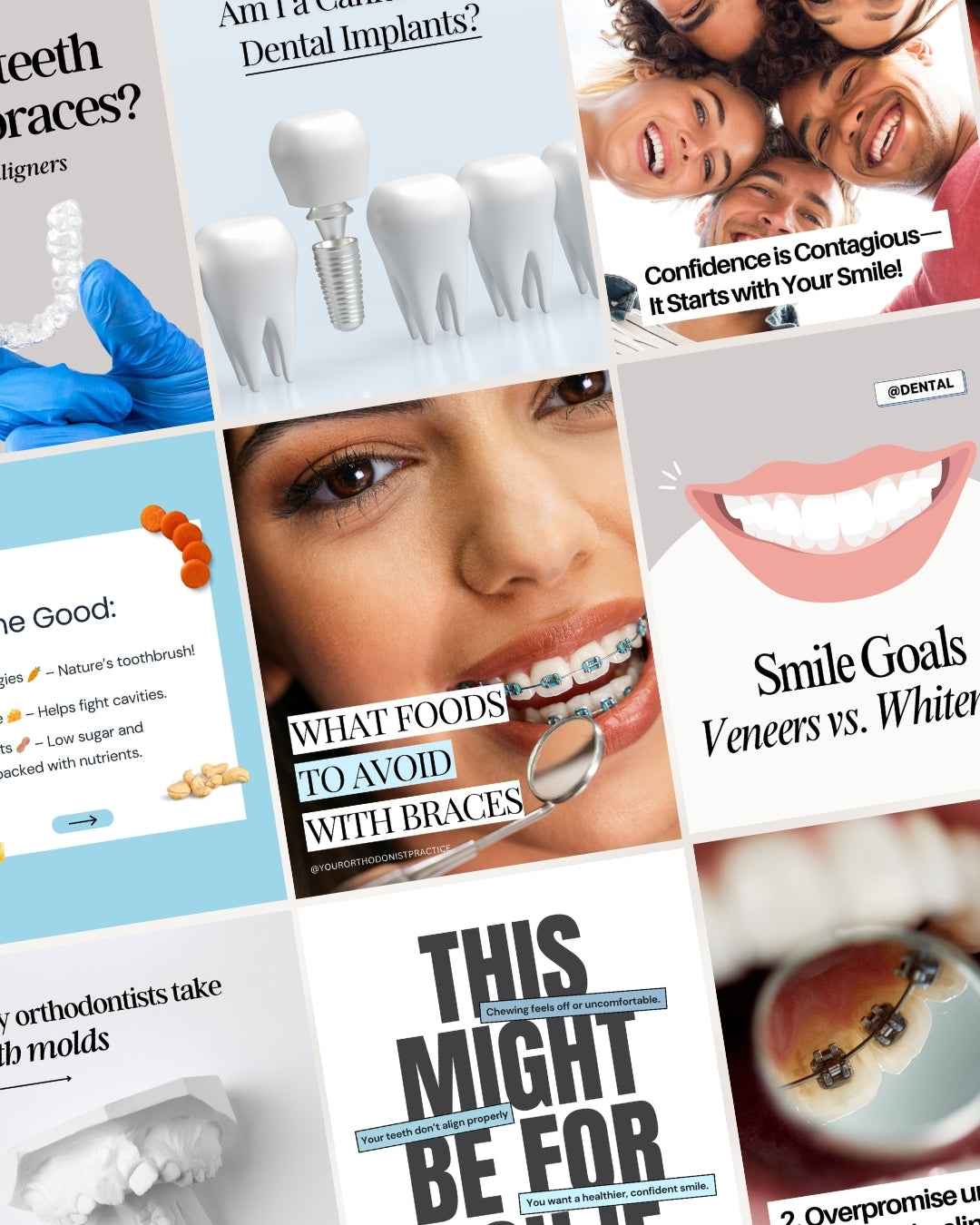 Get high-converting orthodontic Instagram templates to promote braces, Invisalign, and cosmetic dentistry services. This Canva social media kit includes 80 Instagram post templates, 67 engaging story templates, and 31 highlight covers designed to grow your orthodontic practice. Ideal for orthodontists, dental clinics, and marketing teams looking to increase patient bookings and engagement!