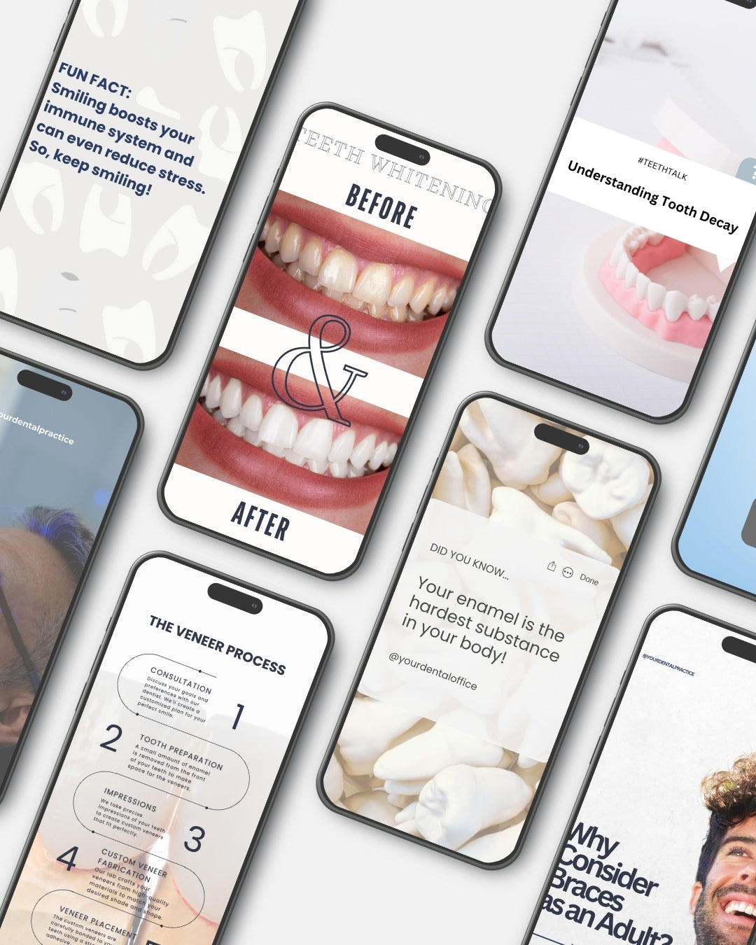 Orthodontic Practice Marketing Templates for Instagram and Facebook