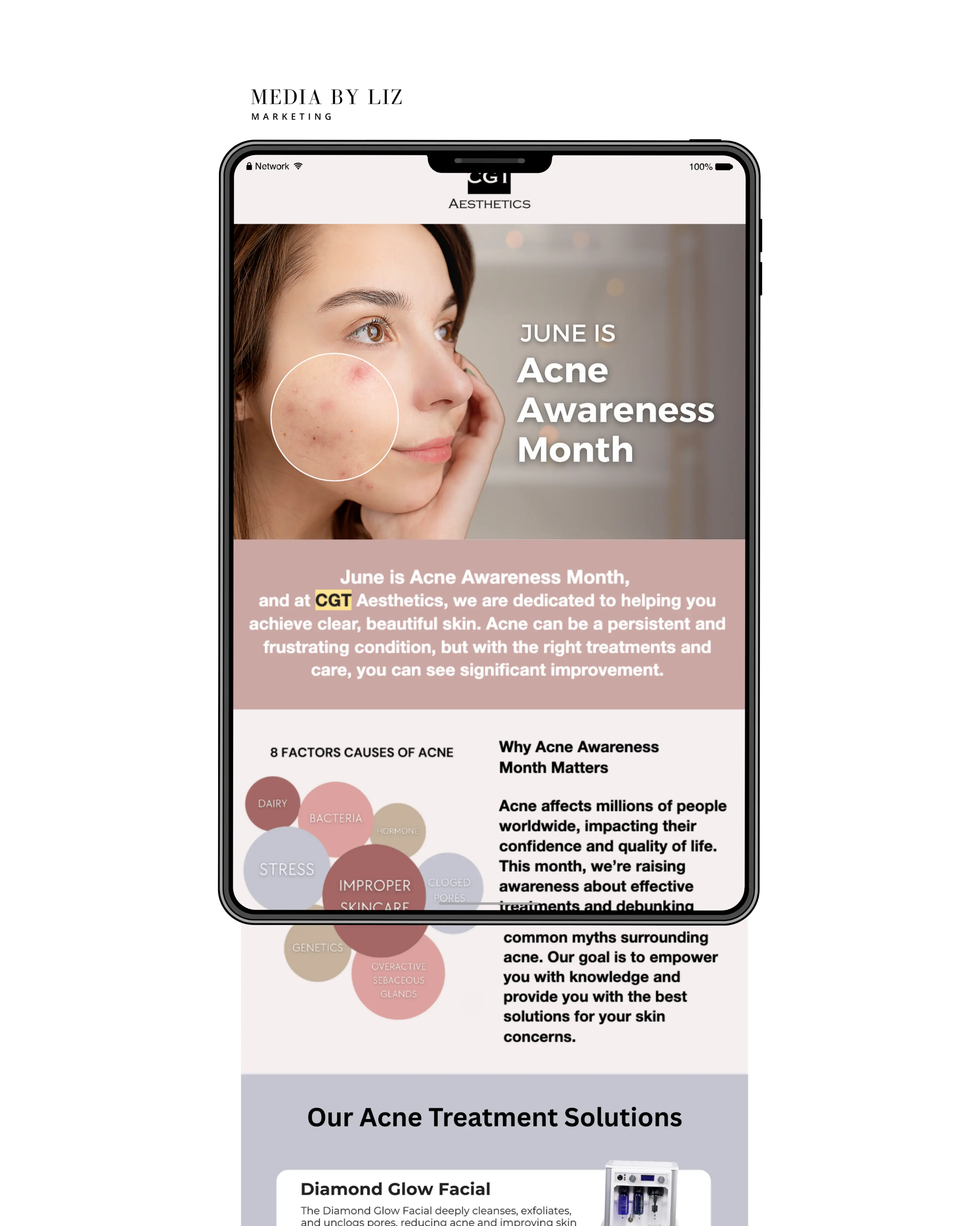 ducational email newsletter for Acne Awareness Month with skincare solutions