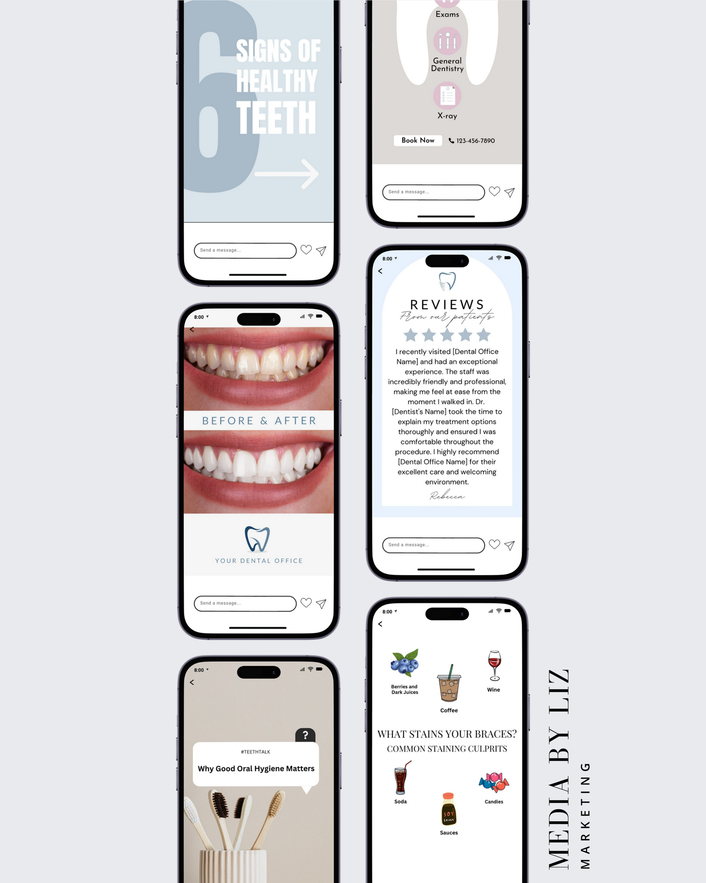 Set of orthodontic Instagram Story templates for braces, bite issues, and clear aligner education — part of a branded Canva marketing pack

