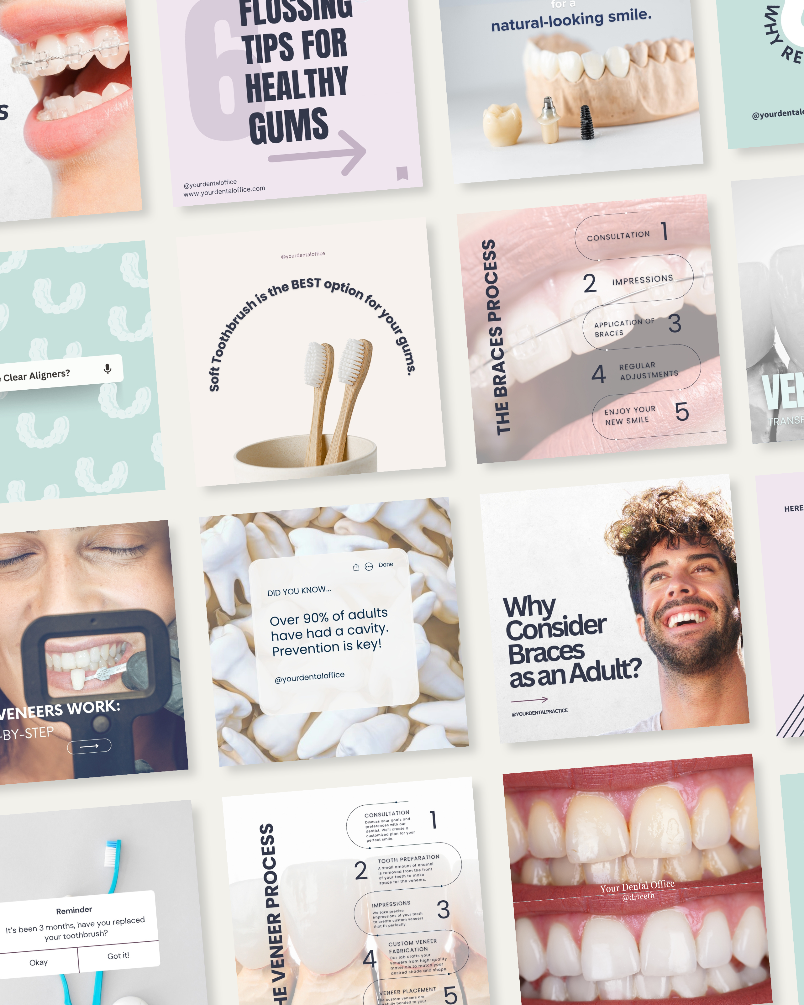 Bright and high-converting Instagram Canva templates for orthodontists, showcasing content on clear aligners, dental hygiene tips, veneers, and the braces process—designed to attract and convert ideal patients online.

