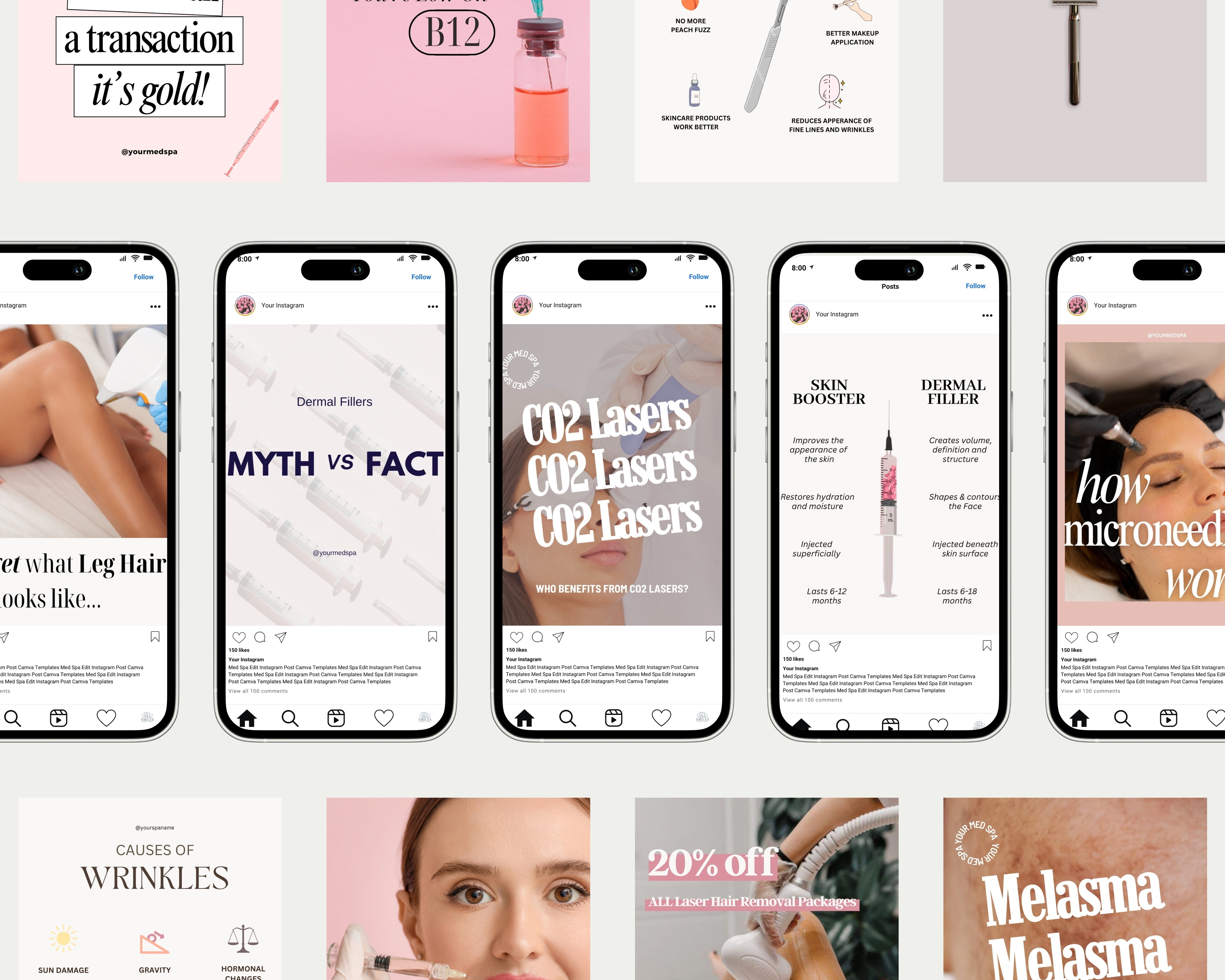 A preview of editable Canva Instagram templates designed for med spas and injectors. Includes posts on CO2 laser benefits, dermal filler areas, microneedling process, hair removal, and self-care motivation — perfect for estheticians, nurse injectors, and skincare professionals looking to educate and attract clients through strategic social media content.