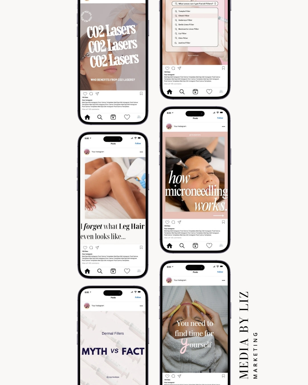 A preview of editable Canva Instagram templates designed for med spas and injectors. Includes posts on CO2 laser benefits, dermal filler areas, microneedling process, hair removal, and self-care motivation — perfect for estheticians, nurse injectors, and skincare professionals looking to educate and attract clients through strategic social media content.