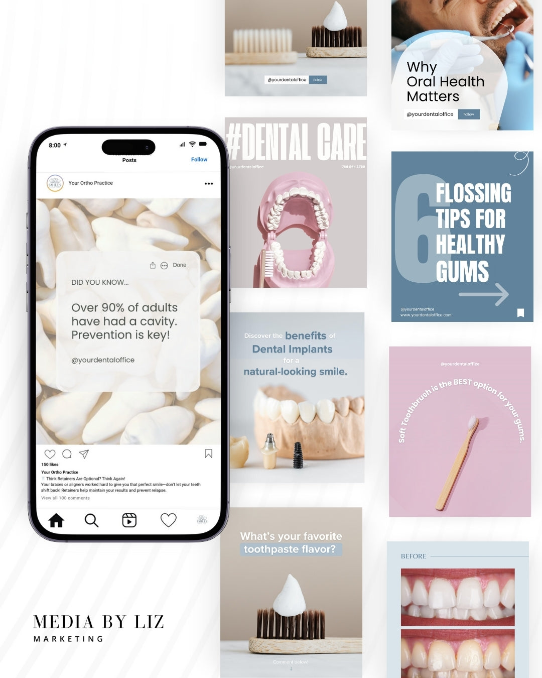 Collection of Instagram posts for dentists including dental implant facts, brushing tips, and oral health education—editable in Canva for dental practices.