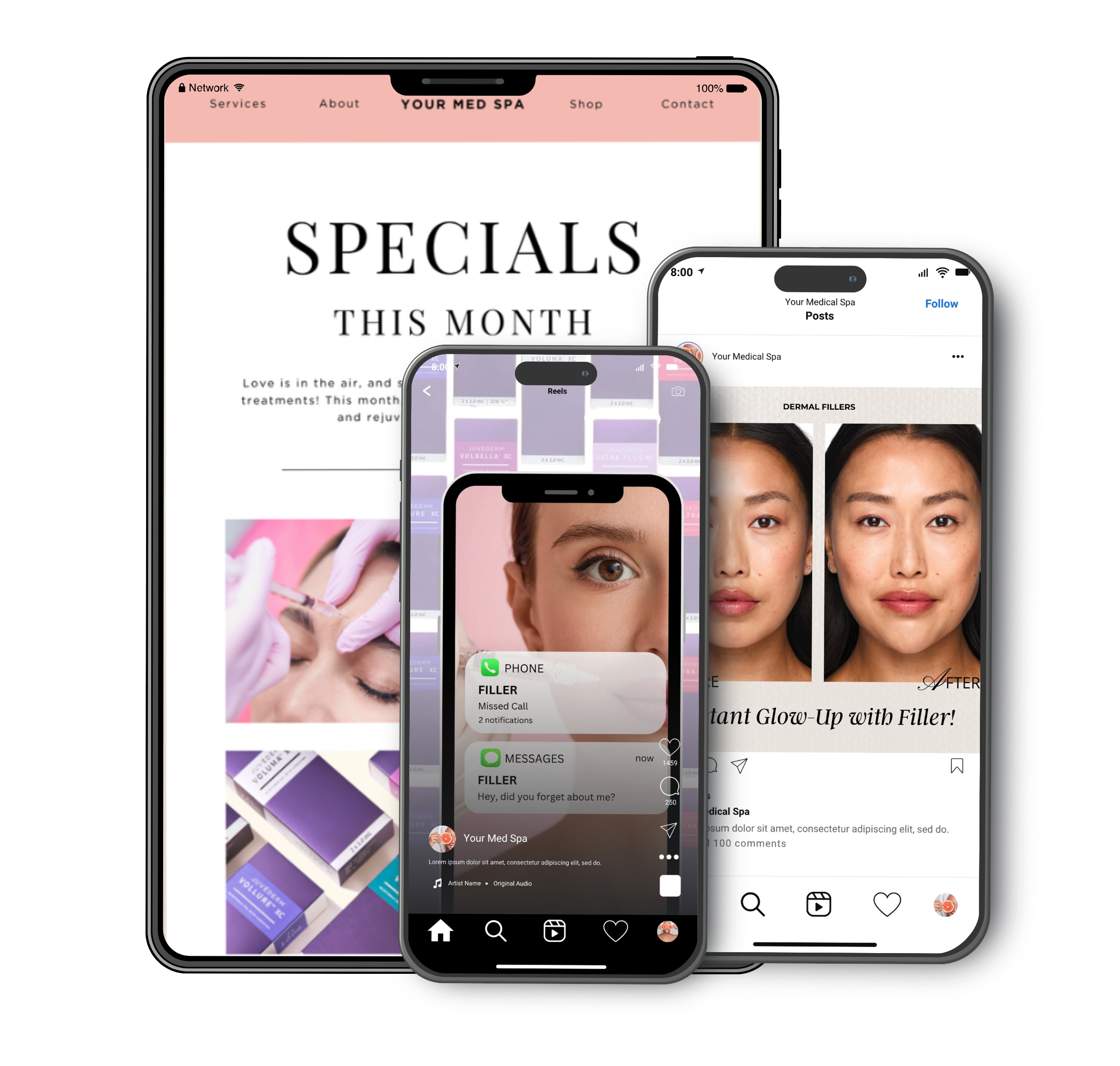 Mockup of editable Canva marketing templates for med spas, featuring Instagram Reels, email specials, and before-and-after social posts for aesthetic services.