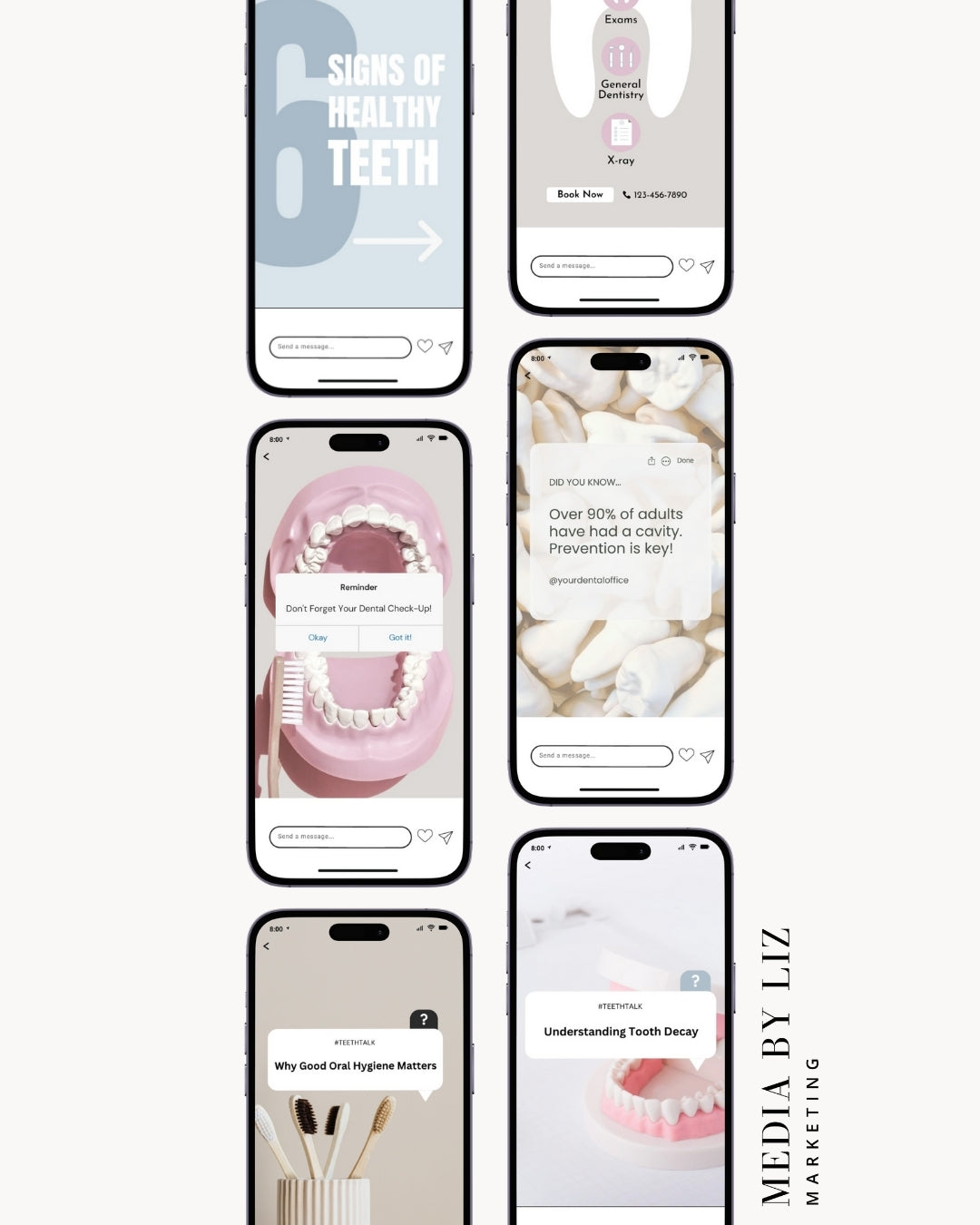 Preview of editable Instagram Story templates for dentists featuring content on healthy teeth tips, toothbrush care, reviews, and patient education in a soft neutral design palette.

