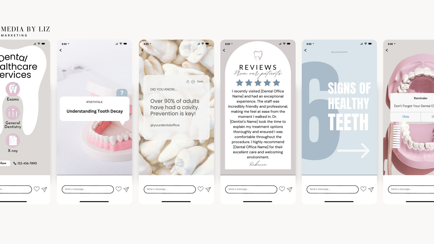 Preview of Neutral Dentist Canva Instagram Story Templates for dental offices, featuring cavity prevention tips, patient reviews, and healthy teeth reminders — perfect for dental social media marketing.
