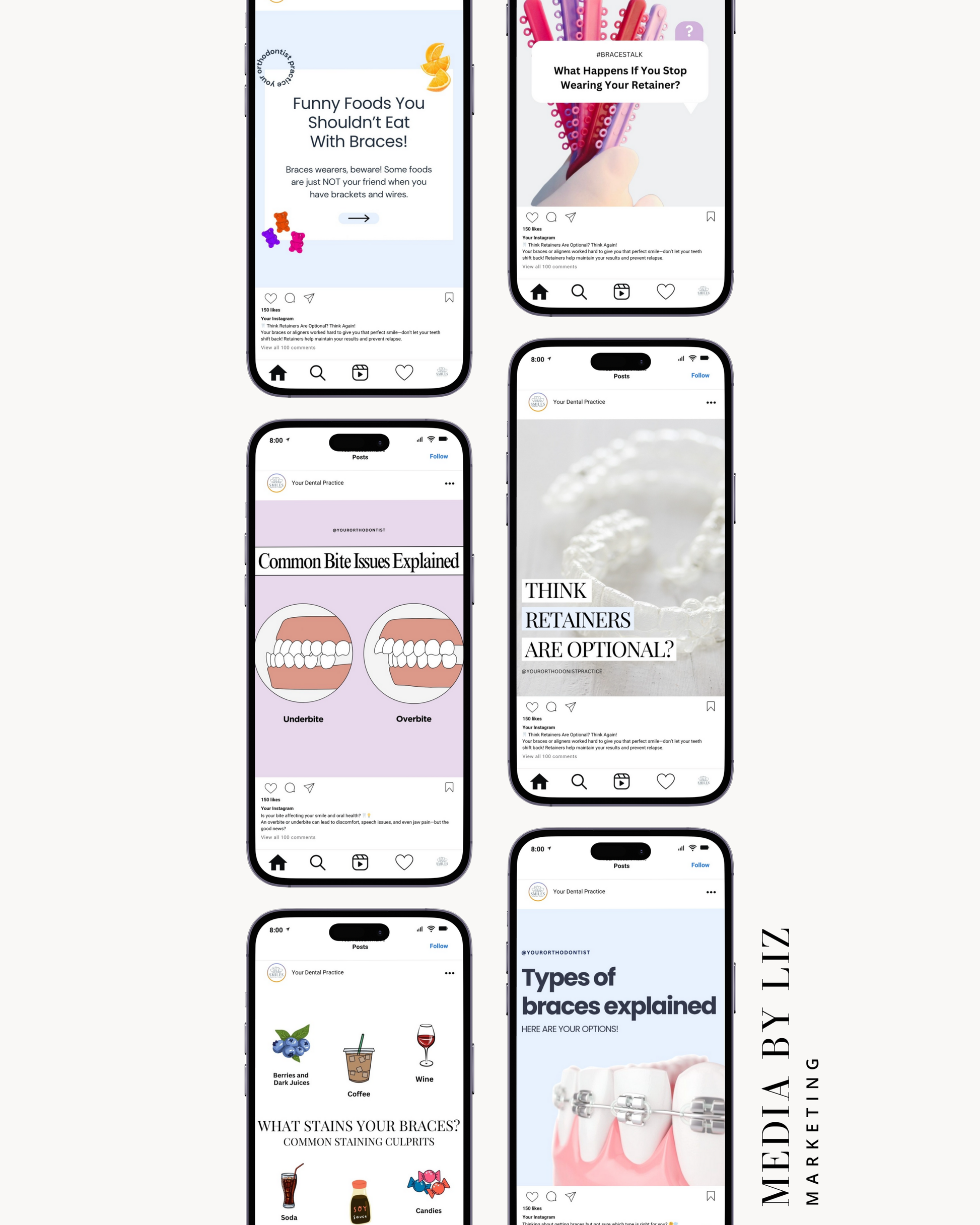 Preview of orthodontist Instagram templates with educational dental posts on braces, bite issues, retainers, and patient tips – designed for dental social media growth.