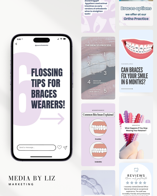 Editable Instagram Story Canva template for orthodontists promoting aligners and braces with pastel colors and custom practice branding

