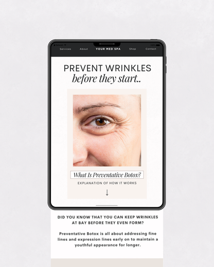 Med spa email template mockup explaining preventative Botox treatments to reduce fine lines and delay wrinkle formation.

