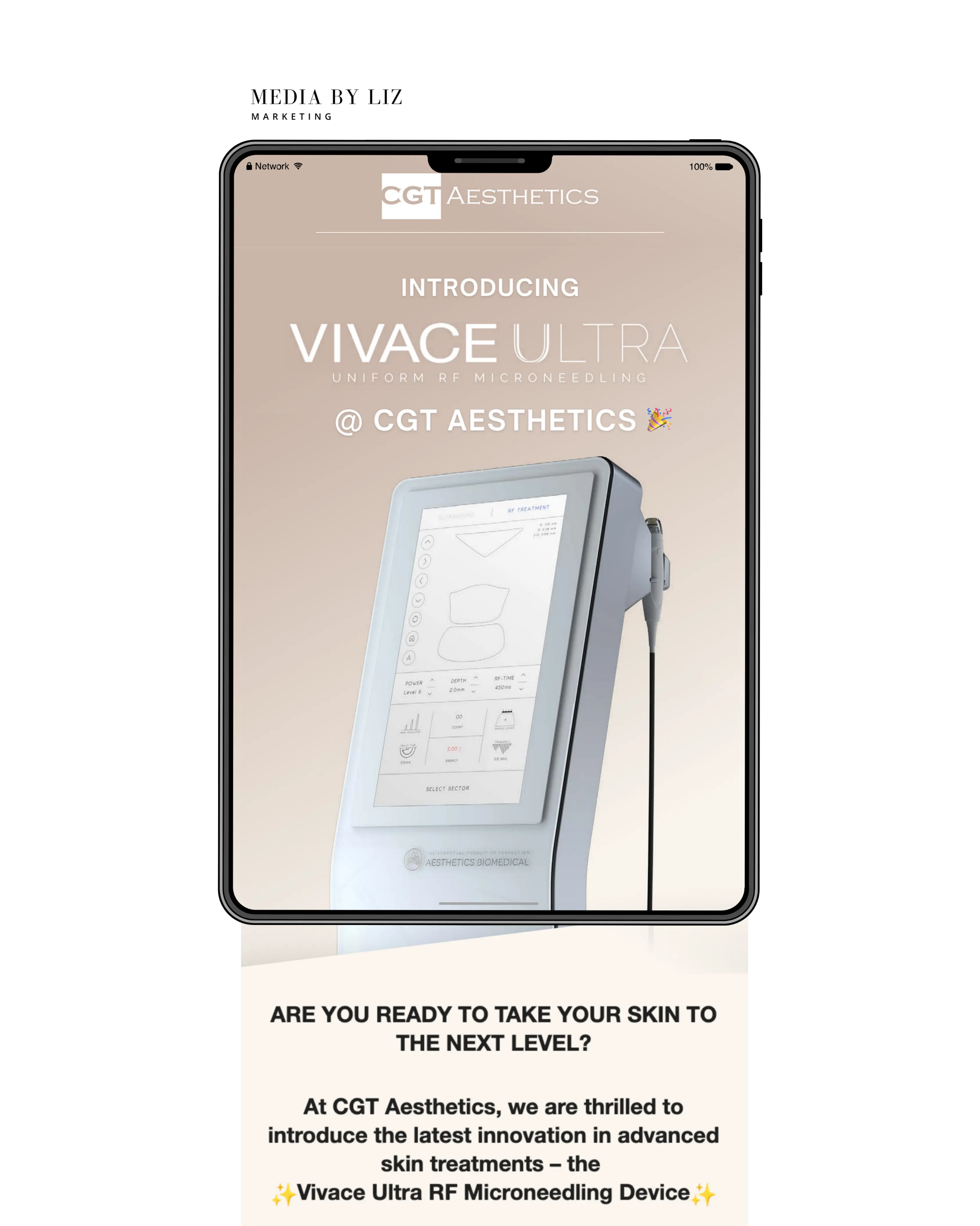 Email marketing campaign announcing Vivace Ultra microneedling treatment launch