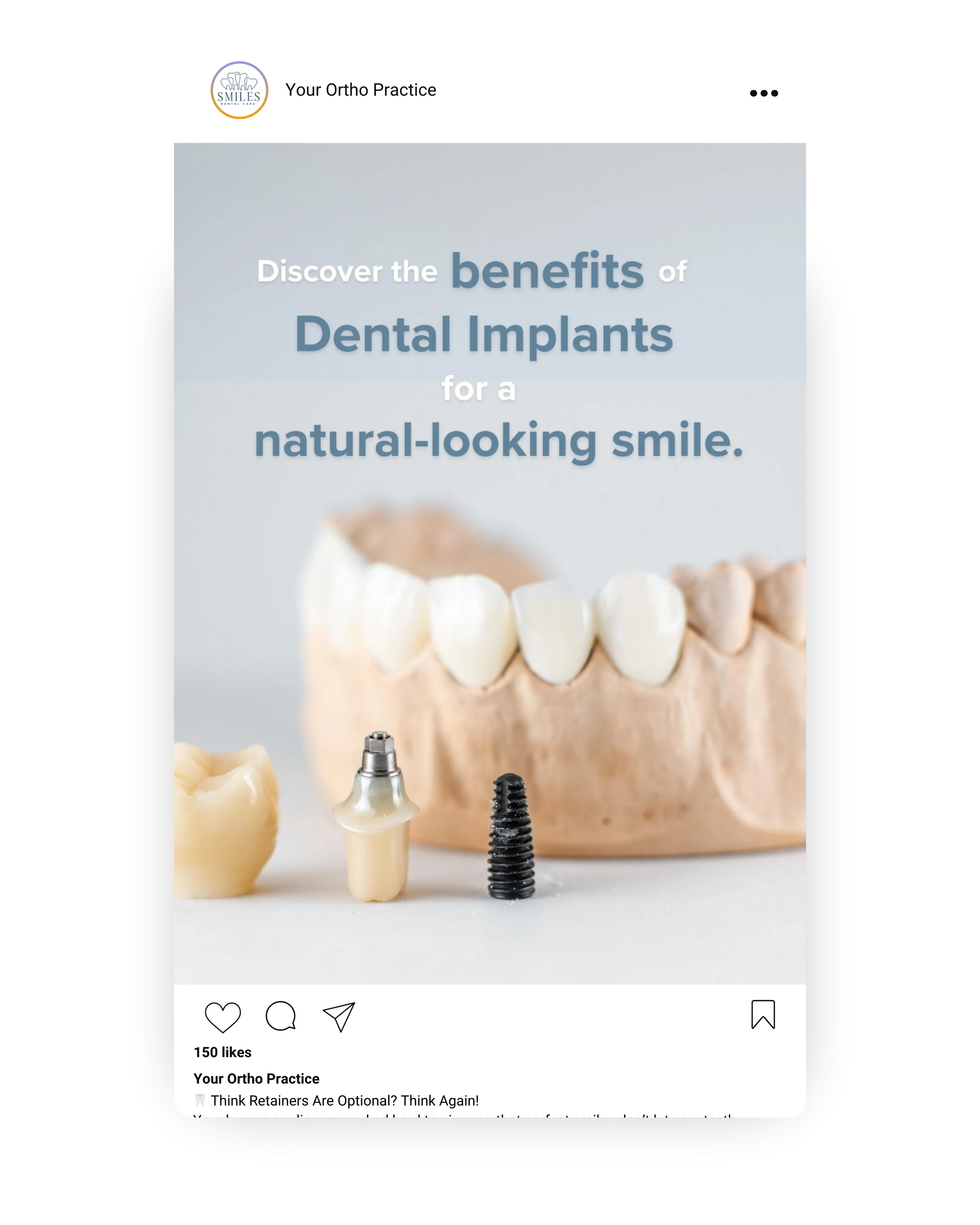 Dental marketing post highlighting benefits of dental implants for a natural looking smile with implant components and tooth model image