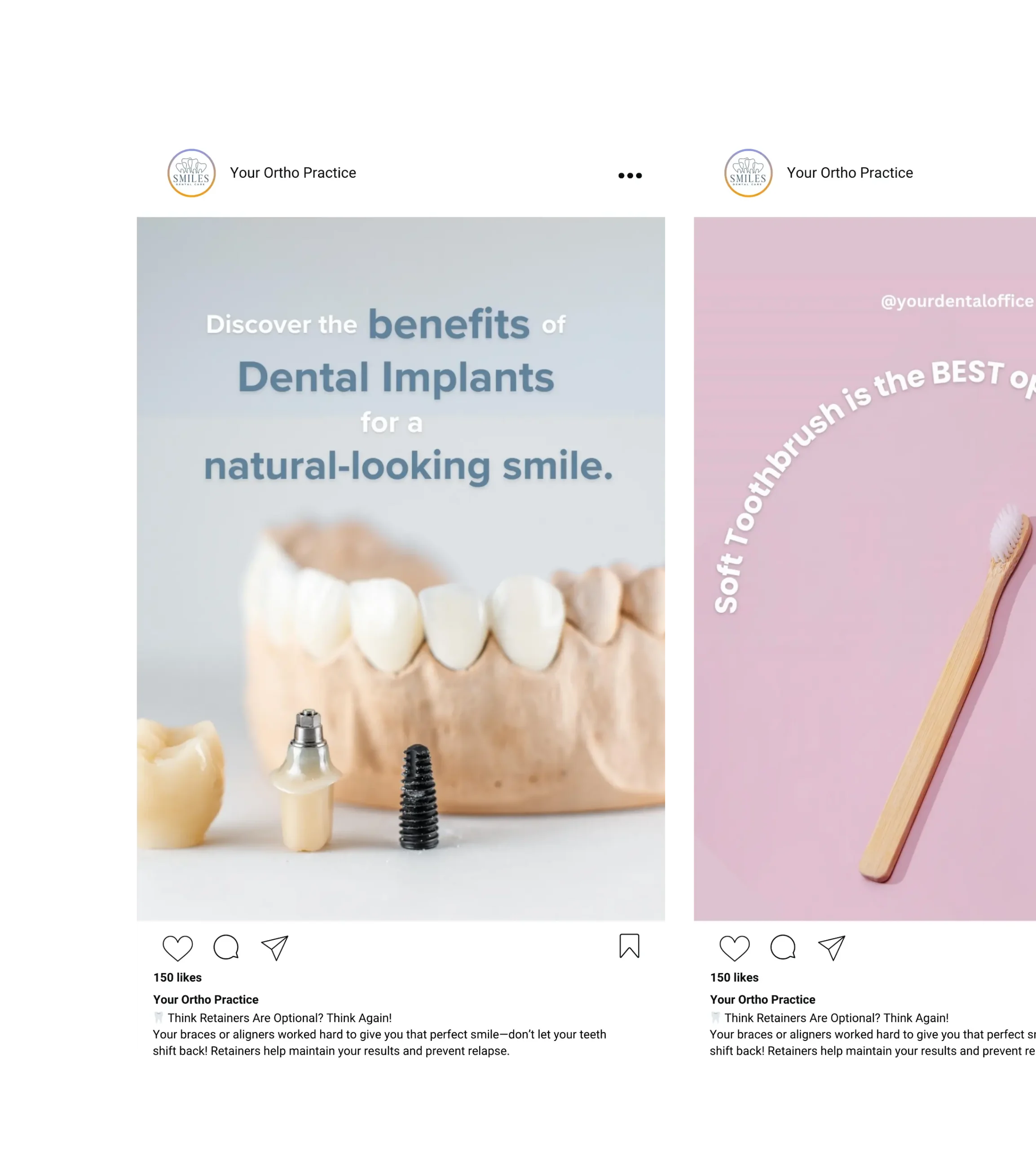 Editable Canva Instagram templates for dentists featuring dental implants and toothbrush care posts for patient education.