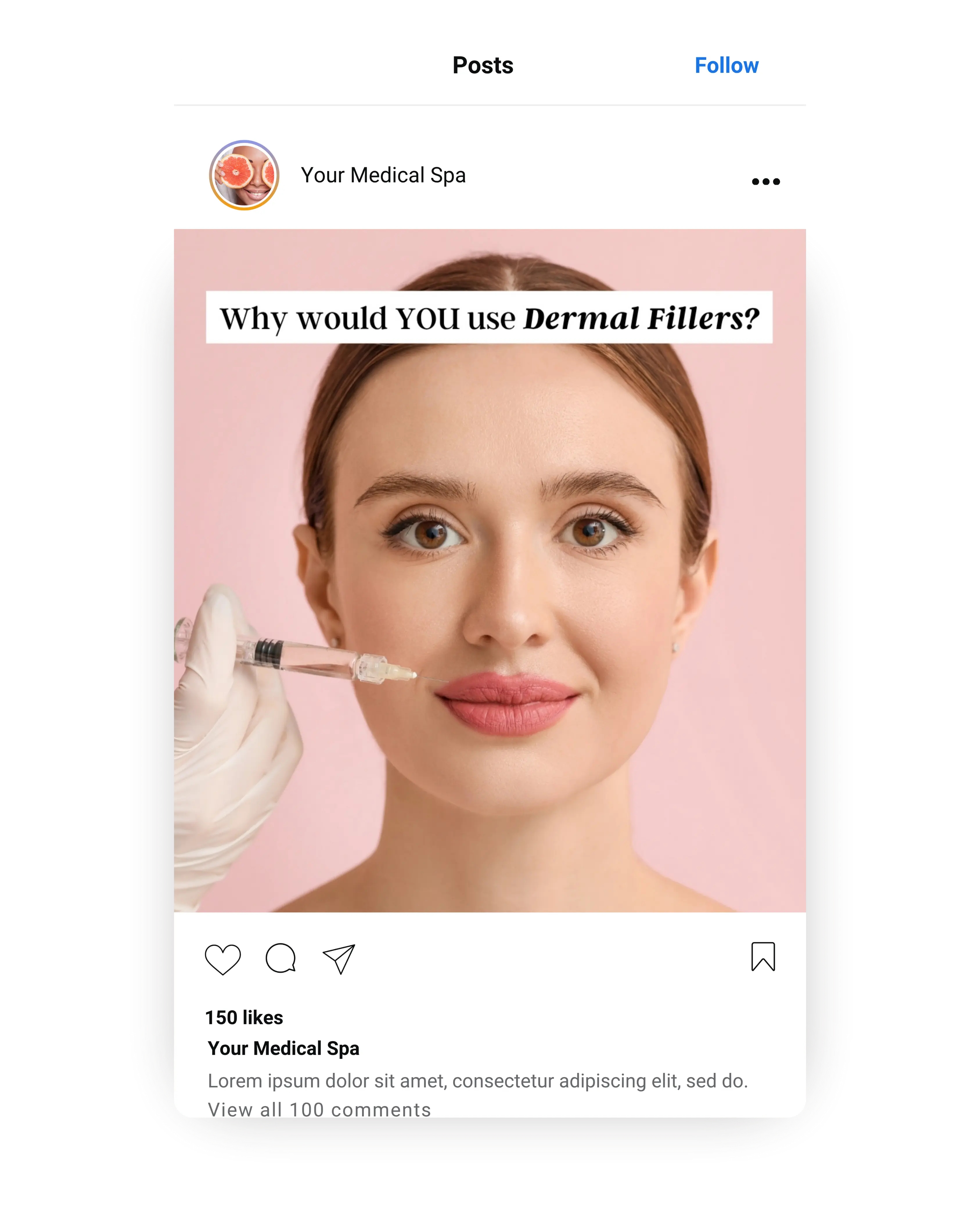 Woman receiving dermal filler injection in lips during aesthetic treatment, educational med spa Instagram post.