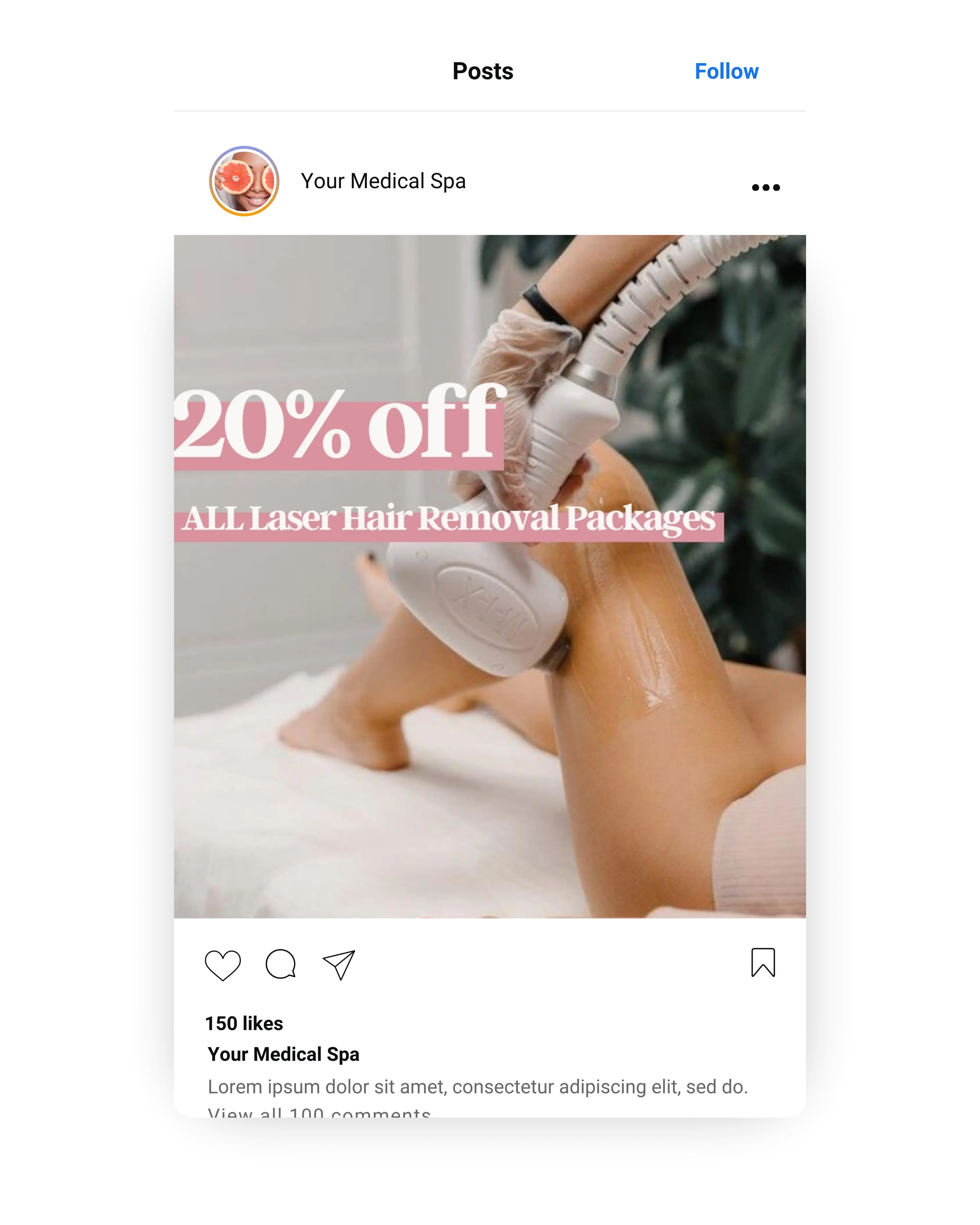 Laser hair removal treatment on legs with 20% off promotional graphic for medical spa marketing.