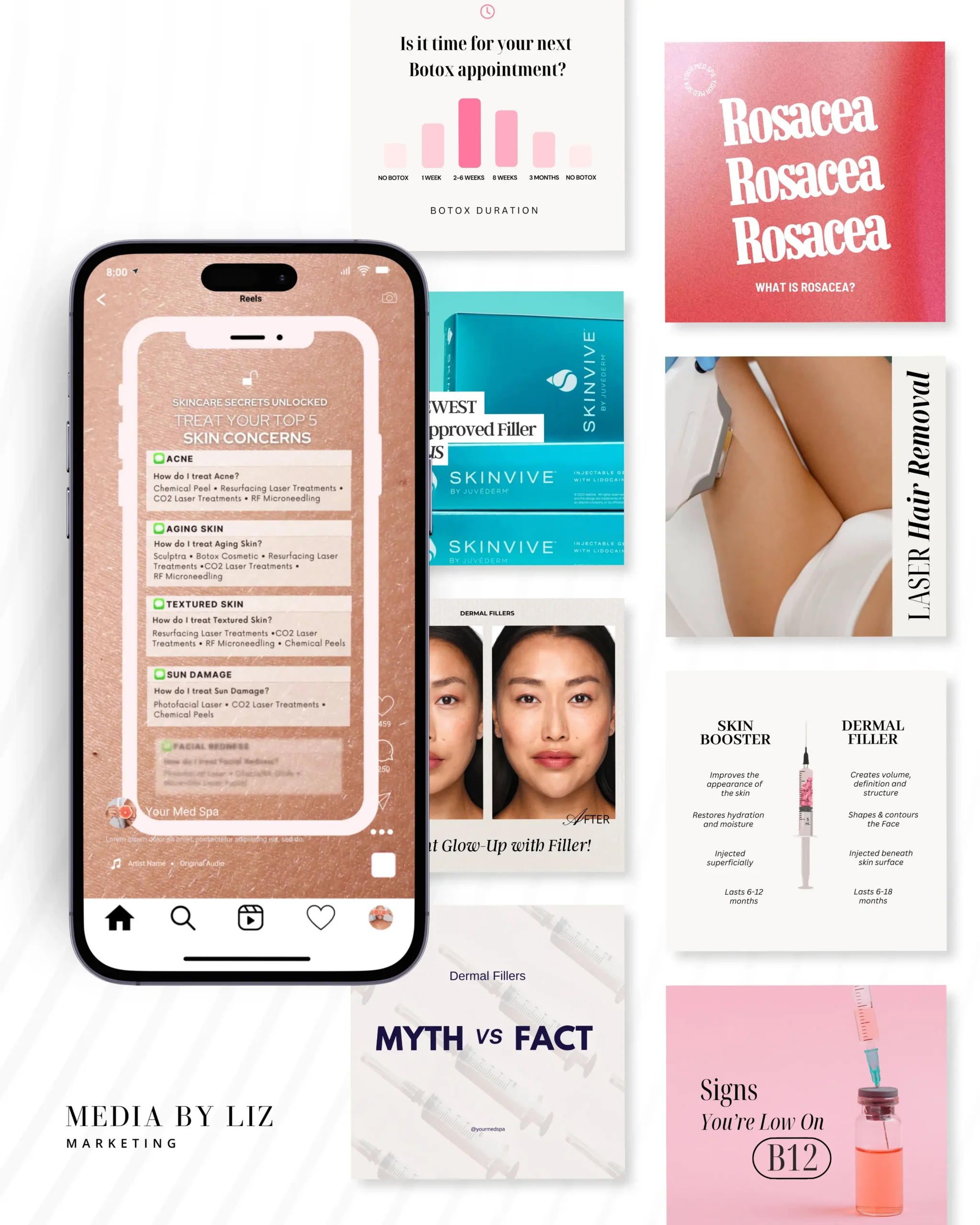 Med Spa Instagram templates Canva bundle by Media by Liz featuring customizable social media posts, stories, and reels for injectors and aestheticians