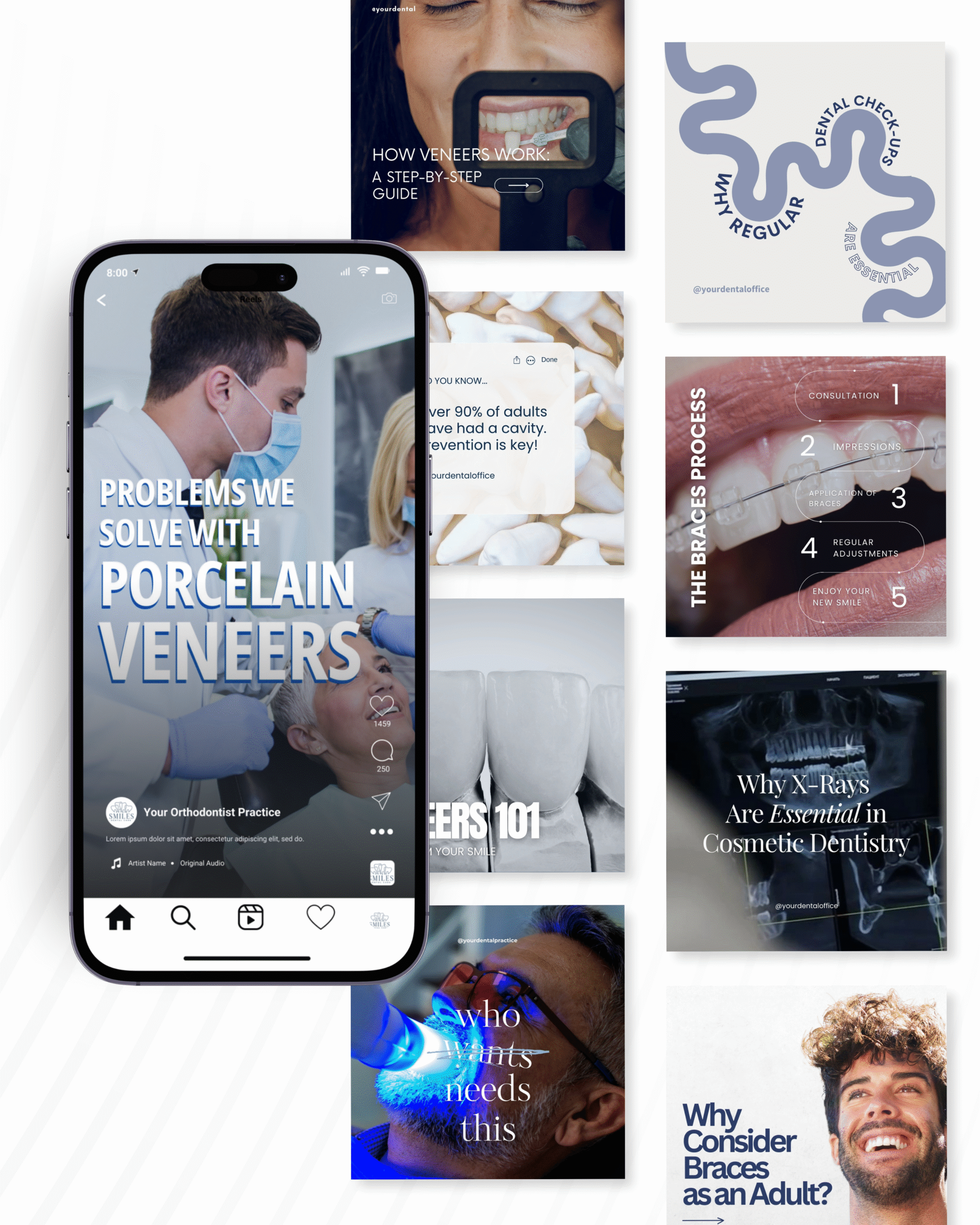 Orthodontic Social Media Templates for Braces and Aligners Marketing