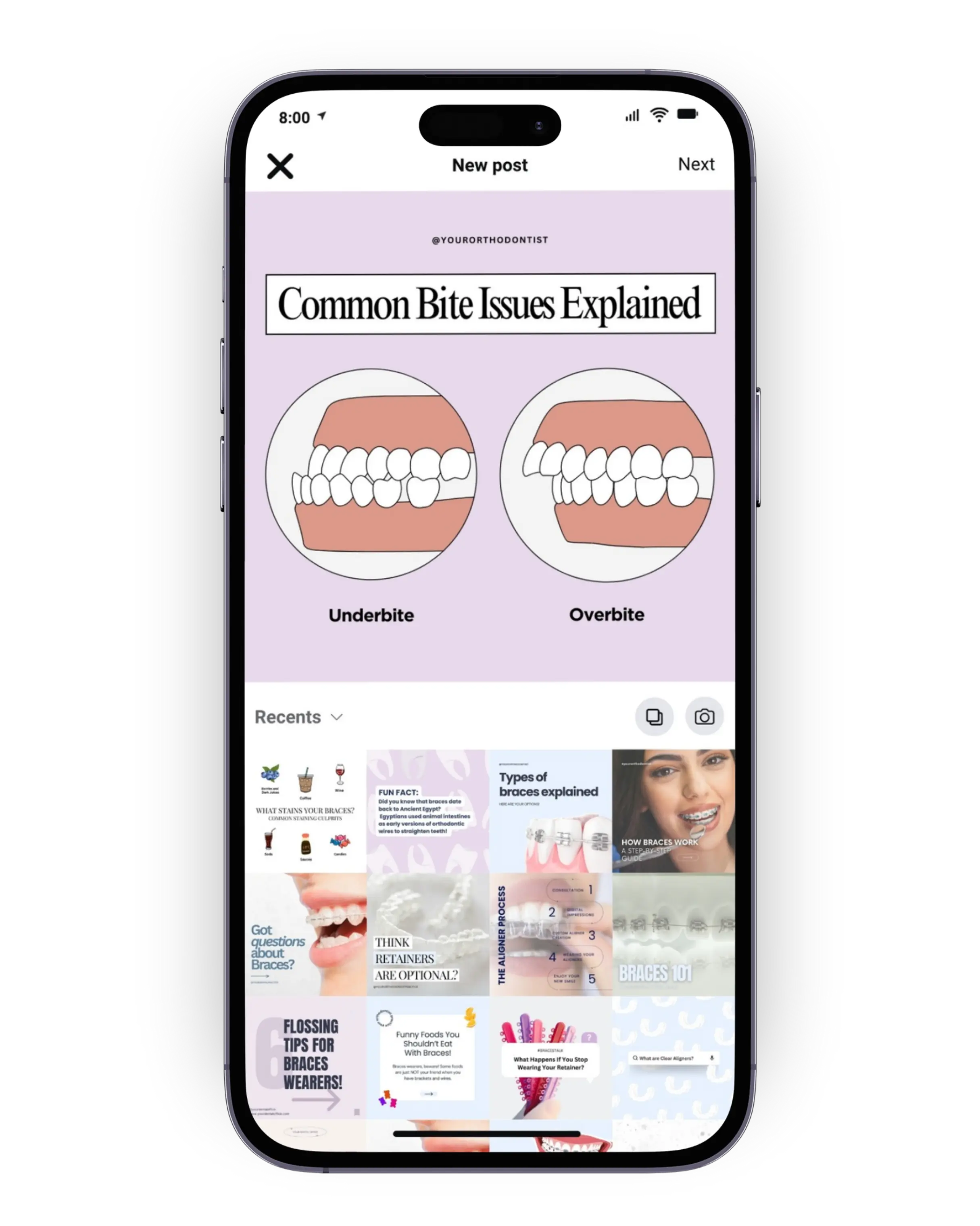 orthodontist-instagram-templates-bite-issues-social-posts.png