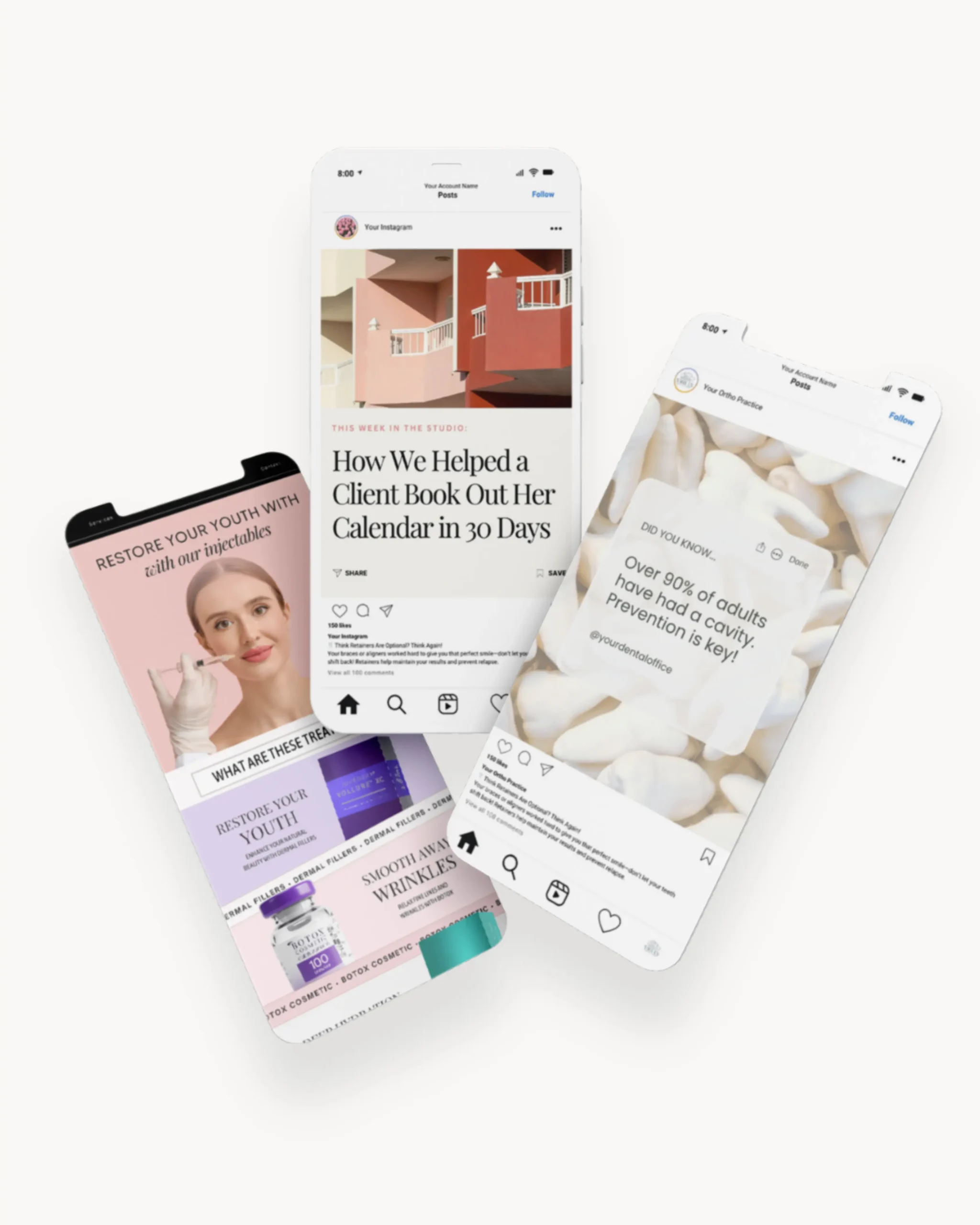 Three smartphone mockups displaying customizable Instagram post templates for med spas, dental offices, and creative businesses designed by Media by Liz. Modern, professional social media template examples showcasing educational, promotional, and aesthetic post designs.
