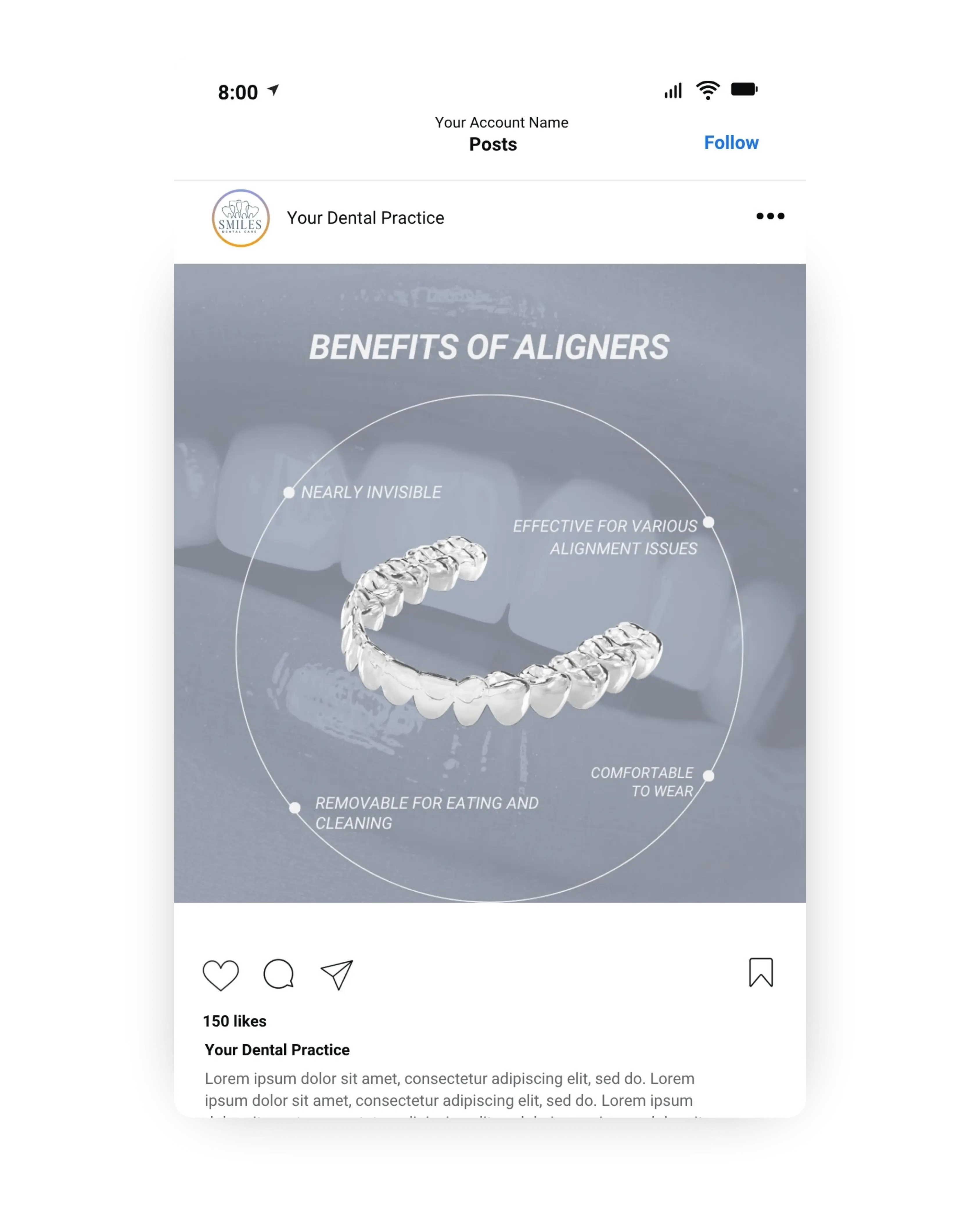 Orthodontic Instagram post highlighting benefits of clear aligners including comfort removability nearly invisible appearance and effectiveness for alignment issues