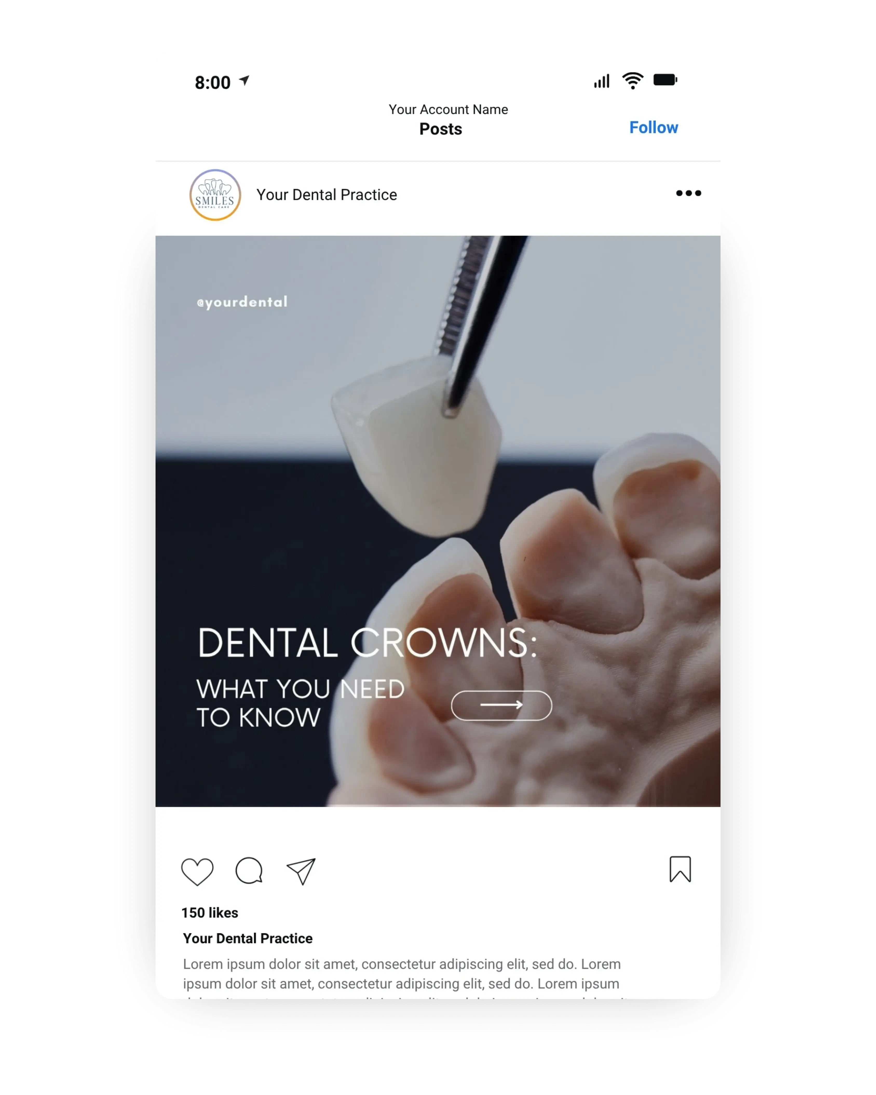 Dental crowns educational template showing a dentist holding a crown above a tooth model, informational dental marketing content for cosmetic and restorative dentistry