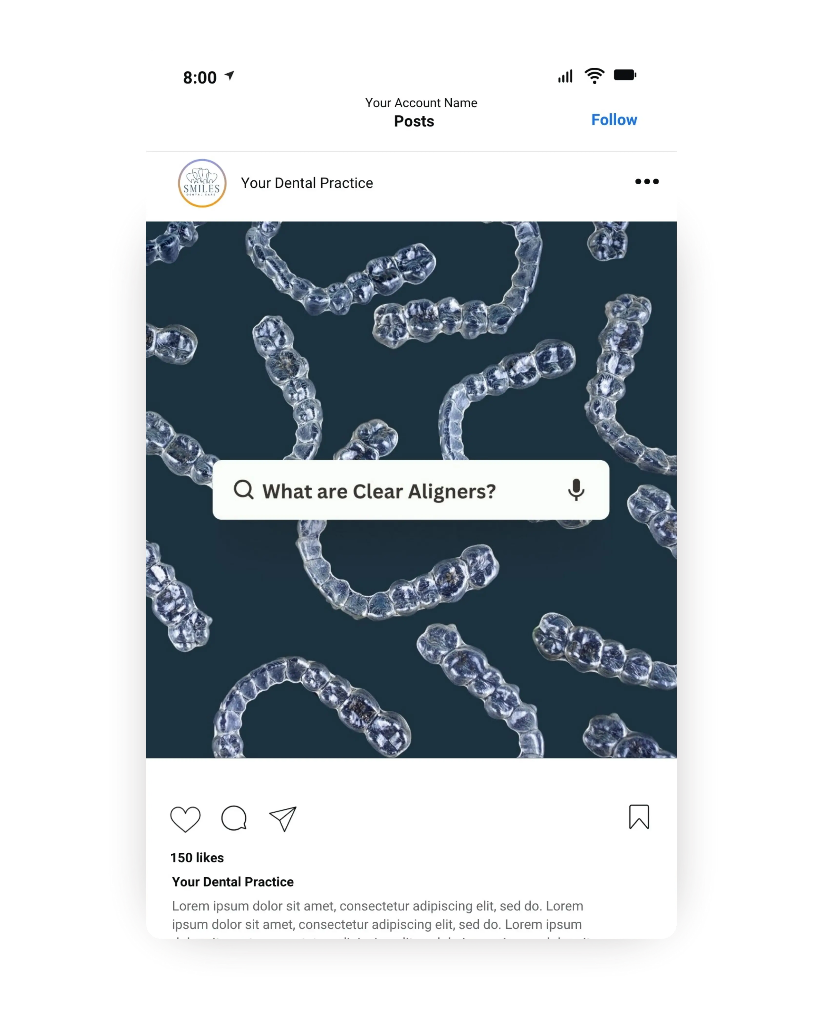 Orthodontic social media post featuring multiple clear aligners on a dark background with search bar text asking what are clear aligners, educational orthodontic digital marketing content