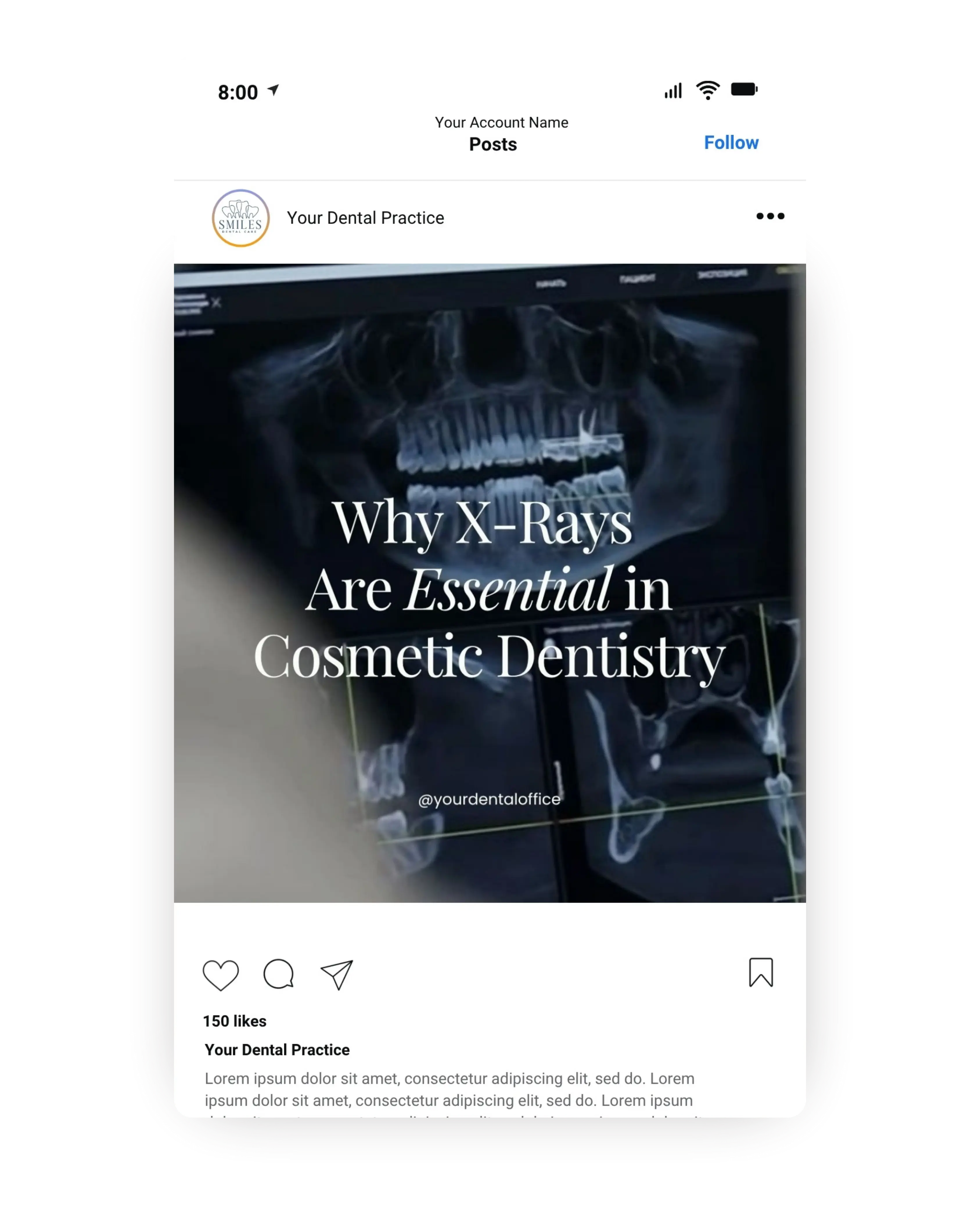 Dental social media template showing panoramic dental X-ray with text explaining why X-rays are essential in cosmetic dentistry, educational content for dental marketing